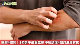 秋老虎來襲，天氣高溫炎熱，人體容易出汗，汗水若未及時擦乾，也可能會導致乾癬病灶惡化，若在炎熱天氣下仍穿著長袖或戴口罩，甚至化濃妝出門，易導致皮膚出現汗疹、濕疹，進而引發乾癬。（勿用）