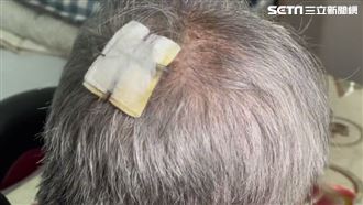 拗請喝飲料嫌等太久　惡鄰暴打雞蛋糕伯