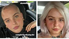 去年11月確診後的那5個月，琳達失去80%的頭髮。（圖／翻攝自TikTok）