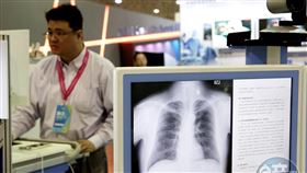 醫療險不保證續保的設計，給了壽險公司商品下架的退路。

