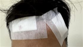 颱風山陀兒強風吹破警局玻璃  員警受傷（1）颱風山陀兒登陸後重創高雄，高雄市警察局三民第一分局2名偵查佐3日中午坐在窗邊辦公時，窗戶玻璃遭強風吹破導致碎片噴濺，其中1人面部遭割傷。（高雄市警察局三民第一分局提供）中央社記者洪學廣傳真  113年10月3日