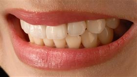 牙齒（圖／翻攝自pixabay）