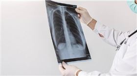 肺癌初期因症狀不明顯，往往被發現時癌細胞已經擴散。（示意圖／擷取自TPG達志影像）