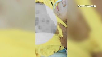 獨／失智嬤躺床全身傷　安養院：自己撞的