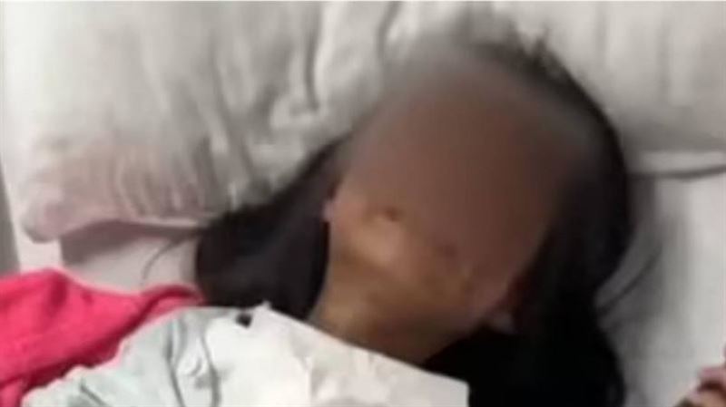 6歲女童被同學潑開水燙傷　校方:不是故意