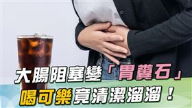 肚子痛 腹痛 竟因「糞石」惹禍！他靠「鼻胃管灌可樂」康復了　驚喊神奇 祝你健康提供