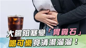 腹痛竟因長糞石！「鼻胃管灌可樂」康復了