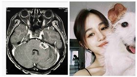 筱蕾曬出腦瘤現狀（圖／翻攝自臉書）