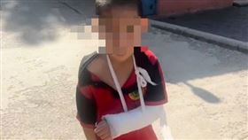 中國一名6歲男童上武術學校被打到骨折。（圖／翻攝自極目新聞）