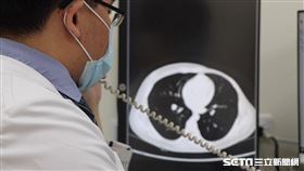 乳癌患者／台中榮總授權提供