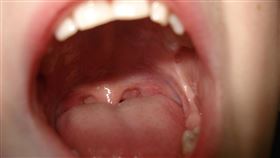 嘴巴、口腔(圖翻攝自/pixabay)