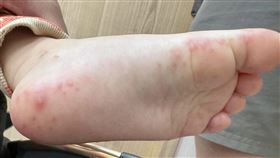 腸病毒肆虐！門診爆炸「很多班級都停課」家長崩潰　醫急示警了　顏俊宇臉書