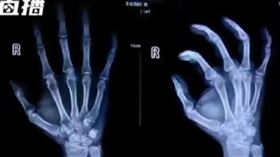 中國一名男子利用假車禍敲詐20萬人民幣。（圖／翻攝自網易新聞）