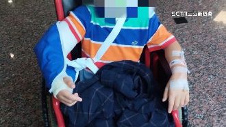 兒跌倒骨折「監視器壞」　家長控幼園隱匿