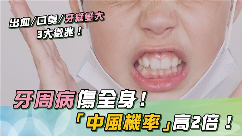 牙周病要小心！醫示警：中風機率飆3倍