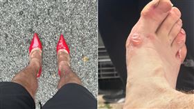 腳上滿是水泡！馬拉松選手「穿高跟鞋」硬跑42公里　為宣揚1理念（組合圖／翻攝自IG＠chargrove15）