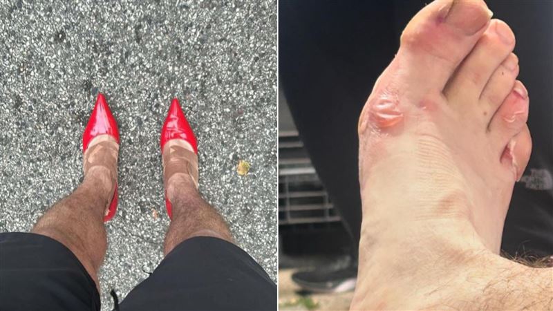 滿腳水泡！馬拉松男硬跑42公里 只為1理念