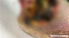 老翁腿傷口發黑顯截肢／院方授權提供