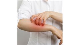 揭開酒疹真相　醫警喝錯酒可能引發嚴重過敏！（圖／姊妹淘）