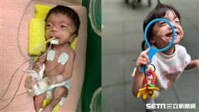 【罕病天使-宓宓】記者張雅筑攝、家屬提供