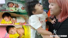 【罕病天使-宓宓】記者張雅筑攝、家屬提供