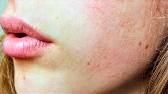 中醫師教你秋季養膚秘訣　讓皮膚柔嫩光滑