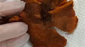 ▲有民眾誤食路邊野菇竟導致中毒出現幻覺。（圖／楊振昌醫師提供）