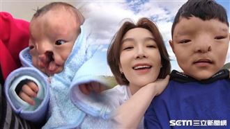 「我沒朋友…」蔡淑臻忍淚陪玩顱顏裂男童