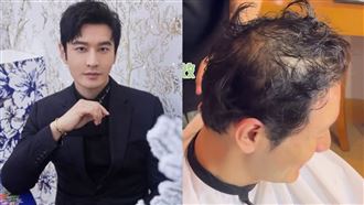 才爆遭討12億分手費　黃曉明慘成禿頭大叔