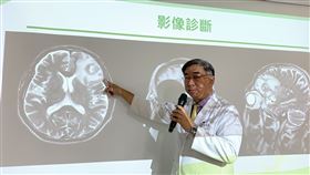 健談男變沉默哥，右側手腳突無力，以為腦中風，卻罹患腦瘤，台中醫院神經外科主任陳典廷(圖／台中醫院提供)