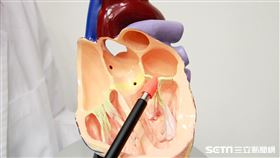 心臟癌／中國附醫提供