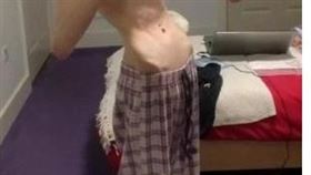 英國,厭食症,爆乳,巧克力,瘦弱（圖／翻攝自太陽報）