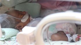 少子化降低外界對早產議題的關心度，易忽略早產兒從出生到成長階段所面臨的嚴重性。（圖／宜蘭羅東聖母醫院提供）