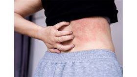 換季肌膚乾癢泛紅！艾莉絲中醫師3招告別敏感！（圖／姊妹淘）