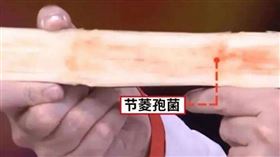 大陸杭州一名53歲婦人近日吃了甘蔗，不料4天後突然陷入昏迷。（圖／翻攝自柳州晚報）