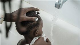 中國廣西桂林市一名奶奶發現2個孫女頭上長了蝨子，於是用沒有稀釋過的殺蟲劑「敵敵畏」（DDVP）原液替孫女們洗頭，導致2名孫女中毒。（示意圖／翻攝pexels）