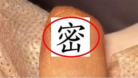 ▲中國一名女子長期做美甲，對指甲造成傷害，長出增生的肉芽組織，並診斷屬於「甲週纖維瘤」。（圖／CTWANT 提供）