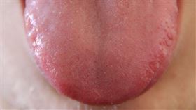 舌頭(圖/翻攝自pixabay)