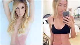 泰勒是醫學上罕見的「嵌合體」（Chimera）。（圖／翻攝自 IG）