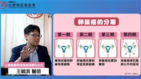 卵巢癌（台灣癌症基金會授權）