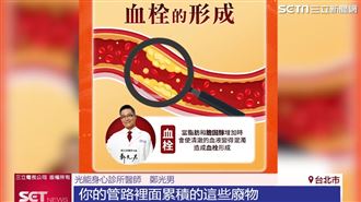 秋冬好發心肌梗塞「專利外泌體」預防阻塞