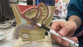 攝護腺癌,達文西,中國醫藥大學新竹附設醫院泌尿科主任陳冠亨,（圖／中醫大新竹附醫提供）