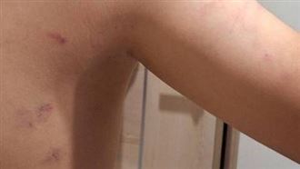 被小6生揮棒攻擊！同校師還原報警關鍵