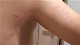 台中，國小，拿樂樂棒揮打，遭老師壓制，報警送警局，小六生傷勢曝(圖／翻攝畫面)