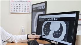 吳晟瑋醫師提醒，肺癌初期幾乎無明顯症狀，難被發現，建議民眾多加使用國健署癌症篩。（圖／臺北醫院提供）