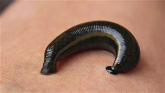 1歲女童「尿布全血」　X光驚見牠鑽私密處