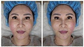 王瑞玲曾拉皮（圖／翻攝自臉書）