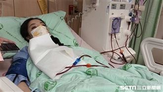 閨密相約隆乳　慘「急性腎衰竭」洗腎搶命