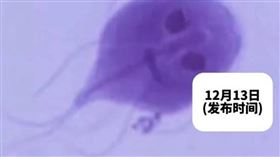 30歲男瘋狂腹瀉2週，糞便驚見「鬼臉」在蠕動。（圖／翻攝自微博）