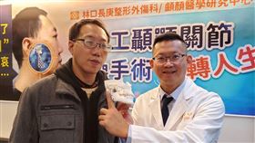 全人工顳顎關節置換助葉先生（左）恢復外觀。（圖／長庚醫院提供）